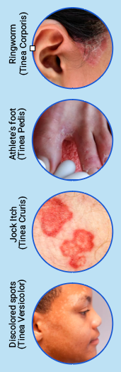+ Expert Anti - Fungal Soap